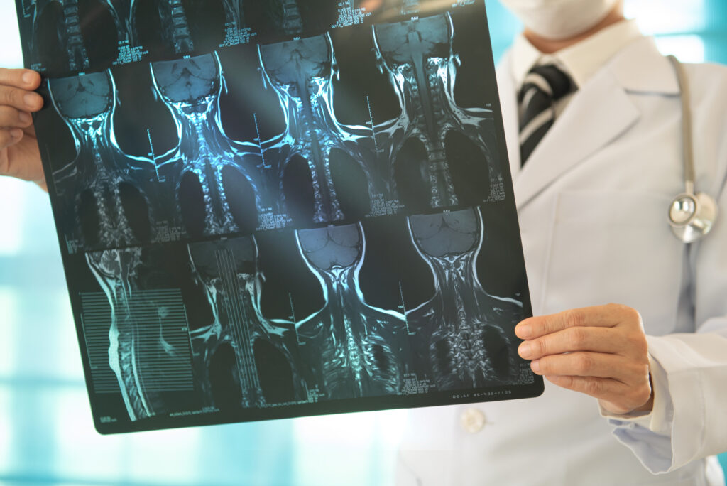 A physician holds images of a head and neck scan