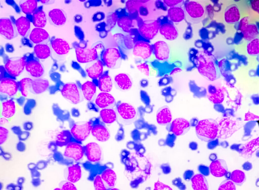 Microscopic view of stained purple cells under magnification.